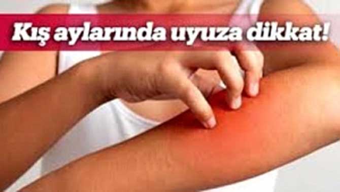 Kış aylarında uyuza dikkat! 
