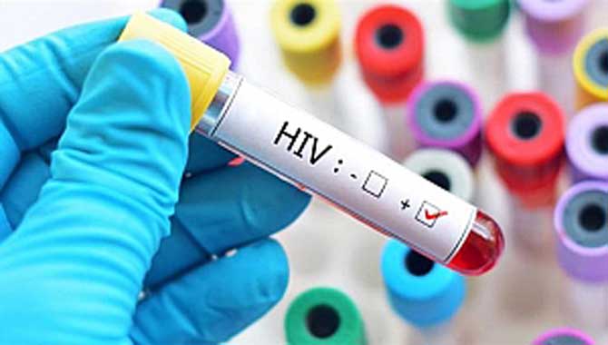 HIV’de Tedavi Mümkün