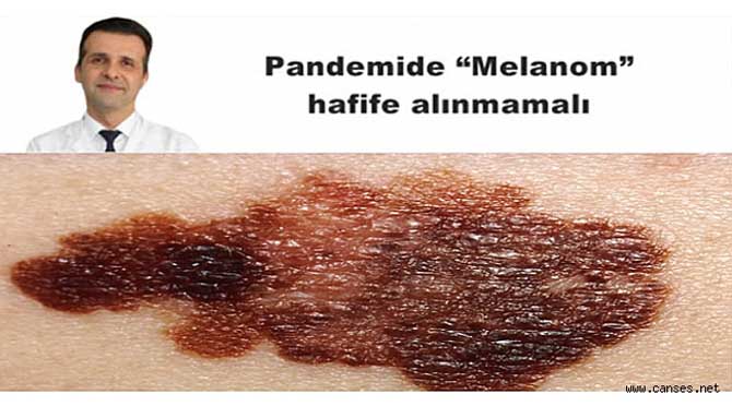 Pandemide ‘Melanom’ hafife alınmamalı