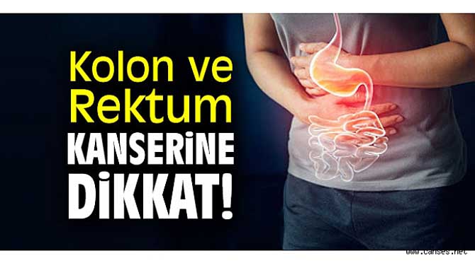 Kolon ve Rektum Kanserine Dikkat!