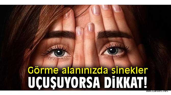 Görme Alanınızda Sinekler Uçuşuyorsa...
