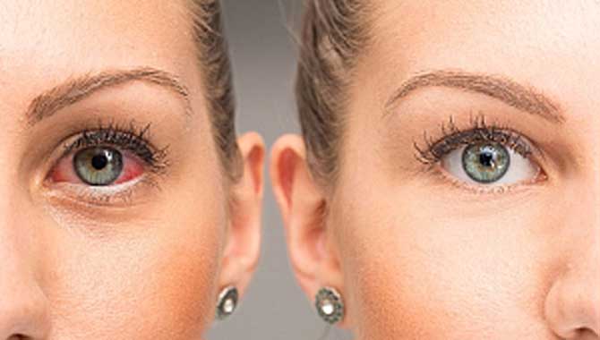 GÖZ KURULUĞUNA KARŞI 6 ETKİLİ KURAL!