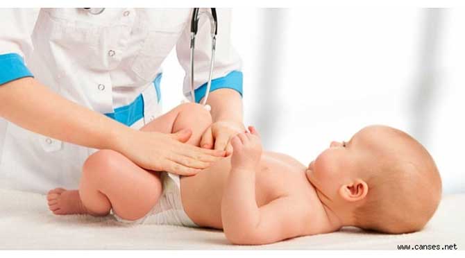 Bebeklerde Bağırsak Felcine (Hirschsprung Hastalığı) Dikkat! 